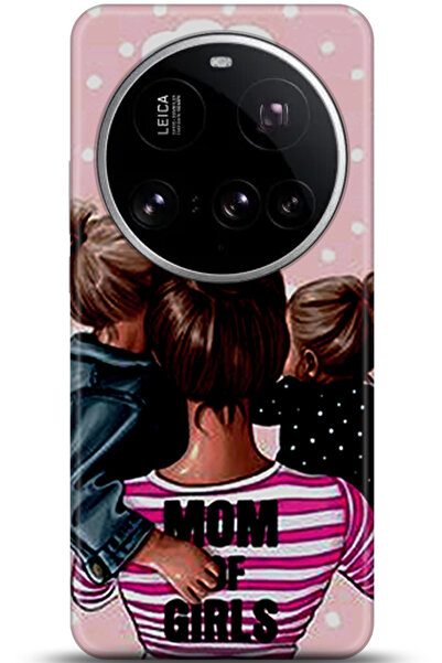 Noprin Xiaomi Mi 15 Ultra Kılıf HD Baskılı Kılıf - A Pair of Eyes 5919