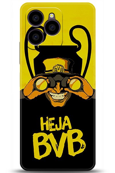 omix X6 Case Hd Printed Case - Keep Following 5634