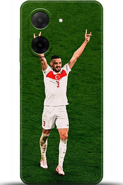 adveksiyon حافظة هاتف Xiaomi Redmi A5 مطبوعة بدقة عالية - ا sigue التتبع 5379
