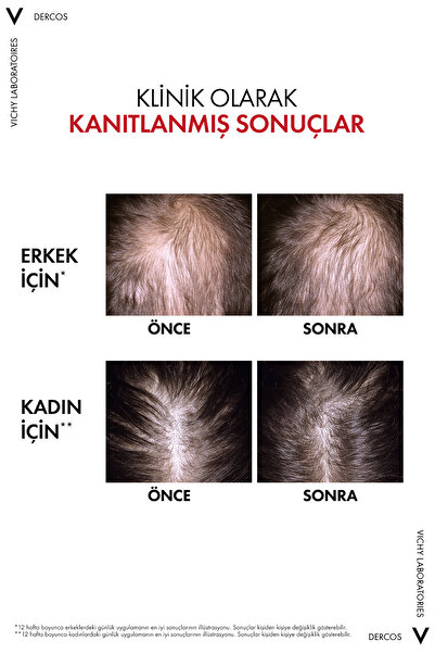 Vichy Aminexil R.E.G.E.N Booster Yenilikçi Saç Dökülmesi Karşıtı Saç Bakım Serumu 90 ml