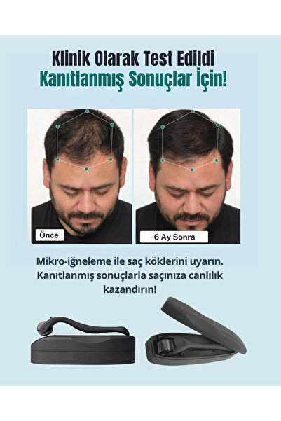 Dermotik Titanyum Uçlu 540 İğneli Dermaroller 1 mm & Dezenfektan Seti–Cilt ve Seyrek Saç Sakal Bakım Aleti