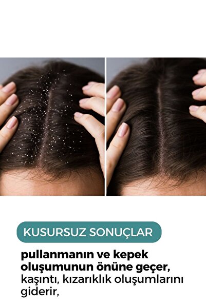 ZENTO شامبو ضد القشرة لفروة الرأس 250 مل