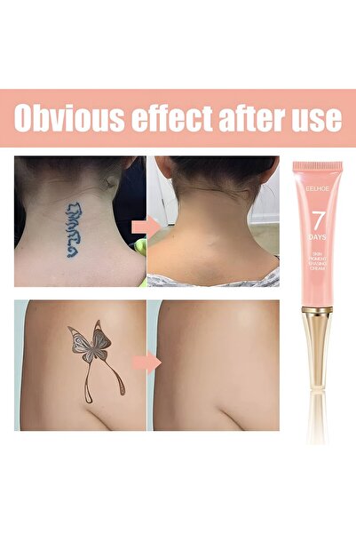 NBNO Ilho Tattoo Removal Cream - 13 g