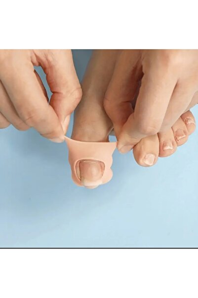 SM6 Batık Tırnak Silikonu