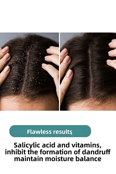 ZENTO Anti-Dandruff Hair Care Tonic 150 ml