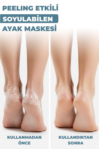 Dermokil Peeling Etkili ( Soyulabilir ) Ayak Maskesi 30 Ml + Onarıcı El Maskesi 30 Ml 2 ' Li Set