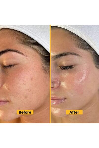 BIOCOS Vitamin C Brightening Serum (2 Pack) Dark Spot Correcting Glow Serum with Collagen, Jojoba Oil 15ml