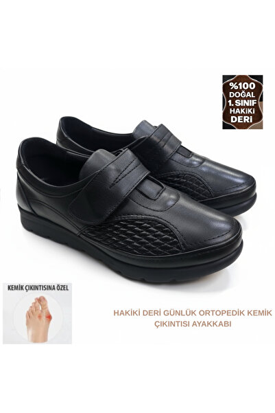 SHOUGO أحذية طبية كاملة من الجلد الطبيعي ذات وجهين لعلاج تشوه إصبع القدم الكبير ونتوء العظام للأمهات