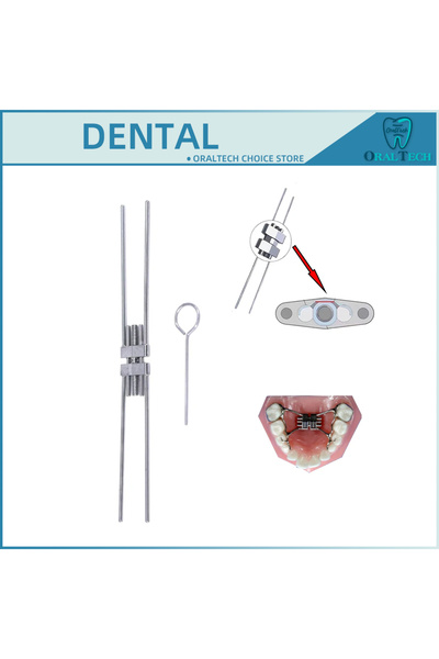 choice2 11 مم، قطعة واحدة من برغي توسيع الأسنان، موسع الحنك التقويمي، نوع الإ...