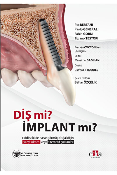 Güneş Tıp Kitabevleri Diş mi? İmplant mı? (Doğal Dişin Korunması veya İmplant Çözümleri Üzerine Kapsamlı Rehber)