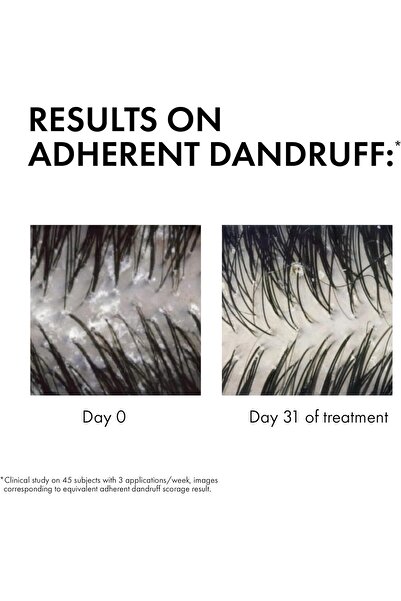 NONAMEE Vichy Dercos Anti-Dandruff Shampoo for Dry Hair