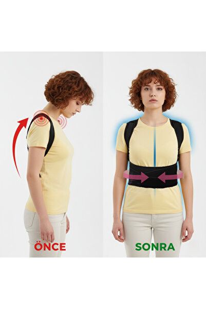 Fashion Form Upright Posture Anti Humpback - Women's and Men's Sports Corset, Back-Waist Underwire