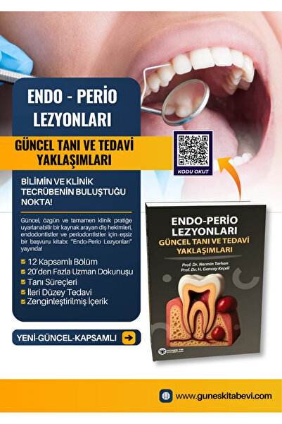 Güneş Tıp Kitabevleri Endo - Perio Lezyonları Güncel Tanı ve Tedavi Yaklaşımları