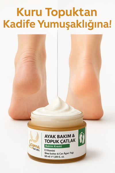 Şeyma natural Ayak Ve Topuk Çatlak Kremi Ayak Bakım Ayak Kokusu 50 ML