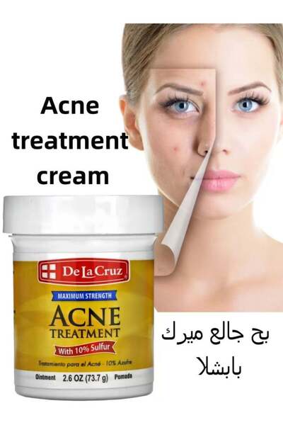 De La Cruz مرهم علاج حب الشباب بالكبريت بنسبة 10%، 2.6 أونصة - مضاد للبكتيريا...
