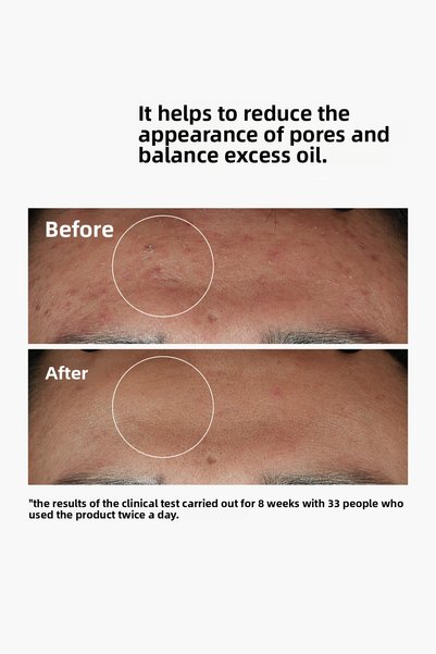 The Ordinary سيروم نياسيناميد 10% + زنك 1% من ذا اورديناري 60 مل