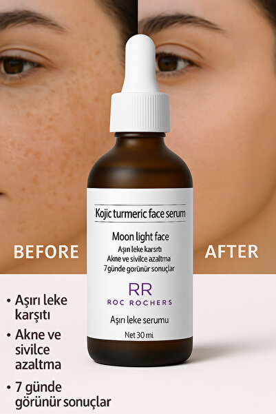 roc rochers Kojic Acid + Turmeric Extract Anti-Blemish Serum |   Skin Tone Eq...