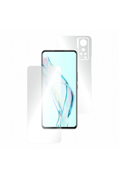 Smart Protection Folie de protecție clasică pentru ZTE AXON 30 5G, corp compl...