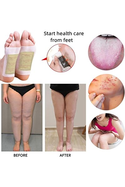 Generic Foot Pads 50Pcs Ginger Foot Patch with Bamboo Vinegar & Ginger Powder