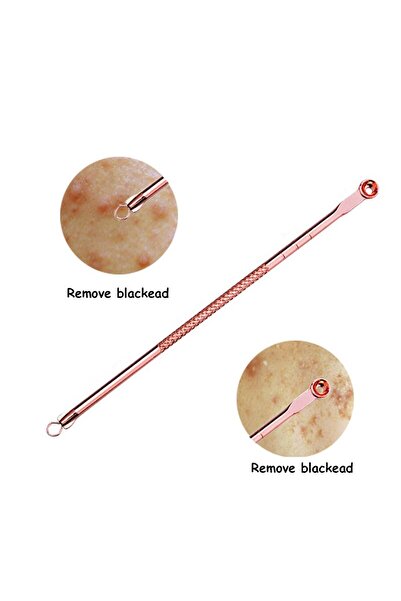 KESNUP Σετ καθαρισμού προσώπου από ανοξείδωτο ατσάλι 4 τεμαχίων Rose