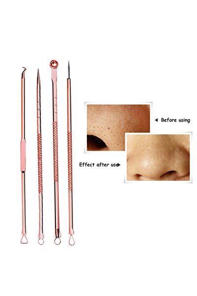 KESNUP Σετ καθαρισμού προσώπου από ανοξείδωτο ατσάλι 4 τεμαχίων Rose
