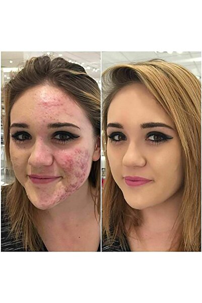 Phoera Aquapurity Full Coverage Foundation Soft Matte Oil Control Concealer 30ml (F101 PORCELAIN)