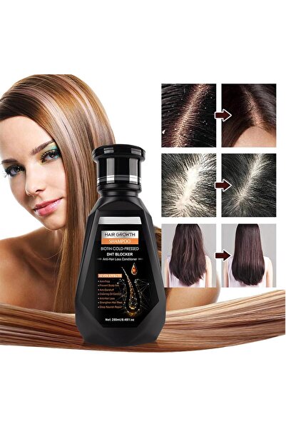 oeny Ginger Anti-Hair Loss Shampoo 250ml - Gentle Cleansing & Oil Control, Strengthens Roots (Men & Women