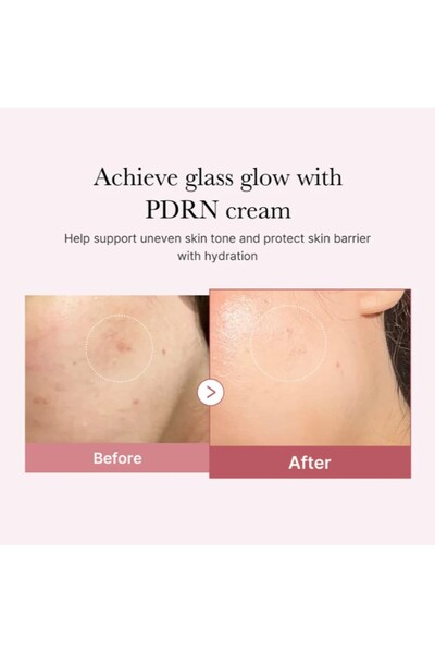 Medicube Ενυδατική κρέμα λάμψης με PDRN και ροζ υαλουρονικό οξύ, Medicube, 50ml