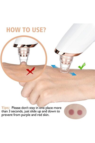 Generic Blackhead Remover Vacuum-Suction Facial Pore Cleaner (3 Levels, 5 Heads) - KK-mall