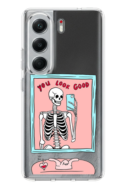 TechTree حافظة سيليكون متوافقة مع هاتف Tecno Camon 40 PRO 5G بتصميم هيكل عظمي...