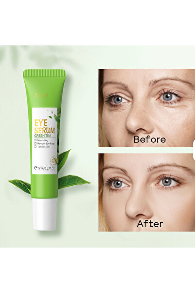 FENYI CREMA CONTUR OCHI MATCHA