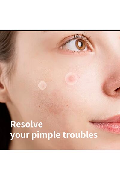 JEJUDO Pimple patch,Akne Bandı(9mm&12mm)+4,5 ml Likit Pimple Pen,%100 Hidrokolloid,%2 Salisilik Asit
