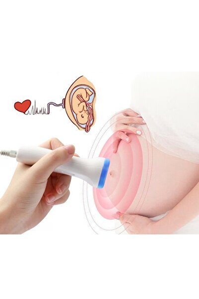 Flippy Fetal Doppler Monitor – Pregnancy Heart Rate Monitor, 4.5 cm LCD, Portable, Blue