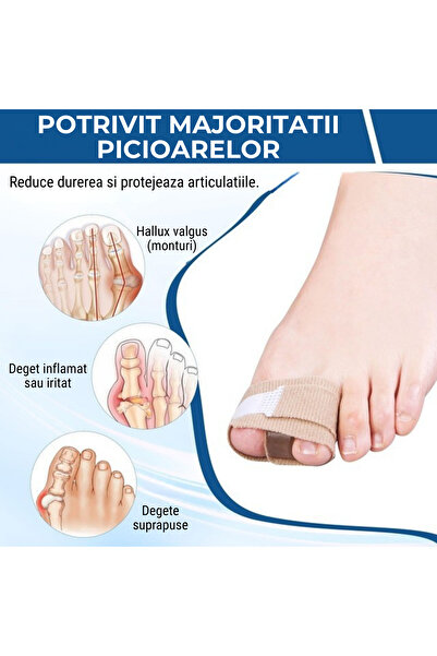 Whimlets Hallux Valgus Corrector Toe Separator, 2 Pieces, Adjustable, Reduces Bunion and Overlapping Toe Pain