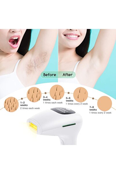 MYWORLD IPL Hair Removal Hair Remover, Permanent Hair Removal Device, Home Use, 500,000 Light Pulses for Men