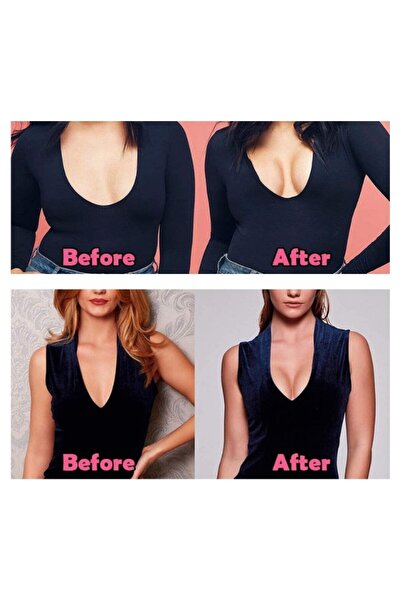 zola Ζώνη ανόρθωσης στήθους, 10 προστατευτικά θηλών, αδιάβροχη, ελαστική και άνετη, 500x5 cm