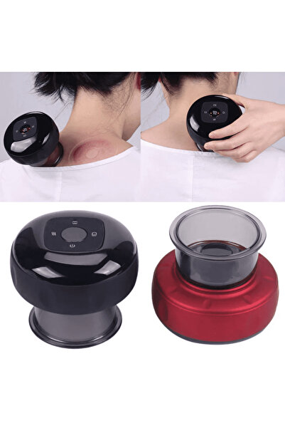 OEMN Massage Device — Cupping Therapy, 12 Pressure Levels with Heating and Display