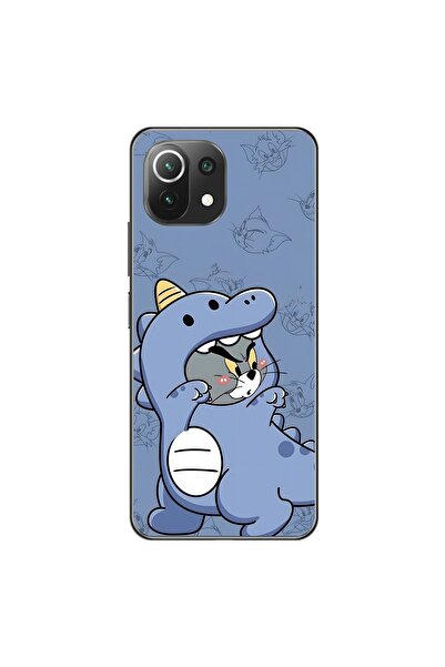 Dali Design حافظة شفافة متوافقة مع هاتف Xiaomi Mi 11 Lite بتصميم Couple Tom 1