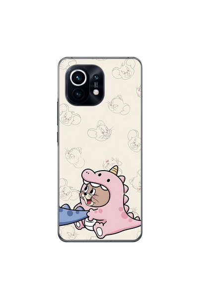 Dali Design حافظة شفافة متوافقة مع هاتف Xiaomi Mi 11 بتصميم Couple Jerry 2