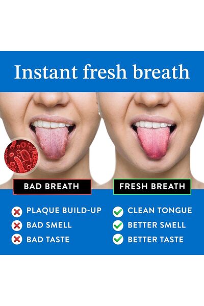 genernic Mouthology Tongue Scraper (2 Pack) - Stainless Steel, Travel Cases, Reduce Bad Breath