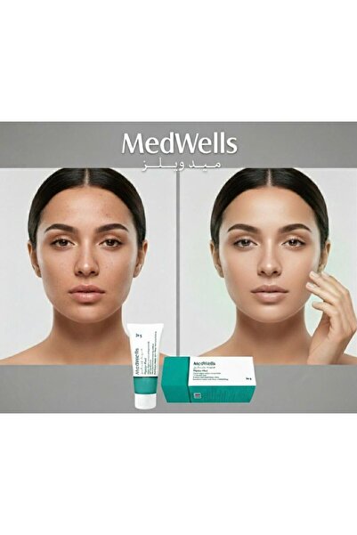 MEDWELLS ميدويلز بيجما ميد كريم تبييض البشره تفتيح الوجه تقشير و منعم و موحد للون MedWell PigmaMed cream 30g