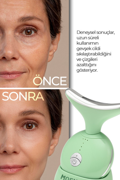 MOEN Yüz Ve Boyun Kırşıklık Giderici Ems Güzellik Cihazı ( Gıdık,Sarkma,Kırışıklık)
