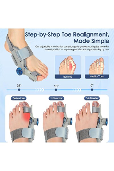 Generic Bunion Corrector for Women and Men — Adjustable Dial with Silicone Pad, Fits Left or Right Foot (1