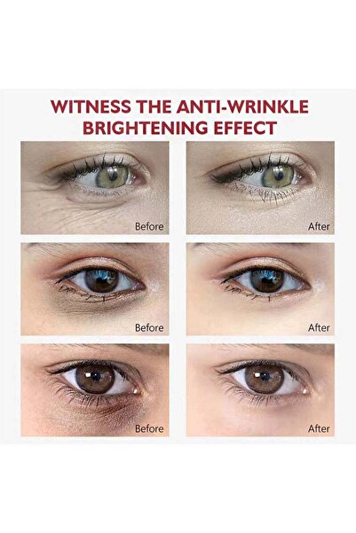 Vibrant Glamour Vibernet Glamour Retinol Eye Cream, Anti-Aging & Anti-Puffiness, Improves Dark Circles and Reduces F