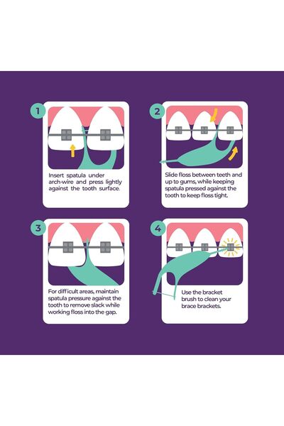 Platypus Orthodontic Flossers for Braces, 30 count (Pack of 1)