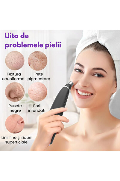 OEMN Microdermabrasion device, 3 intensity levels, with skin cleansing function