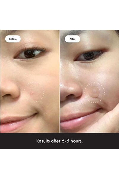 Hero مايتي باتش