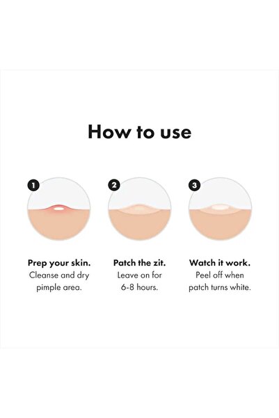 Hero مايتي باتش