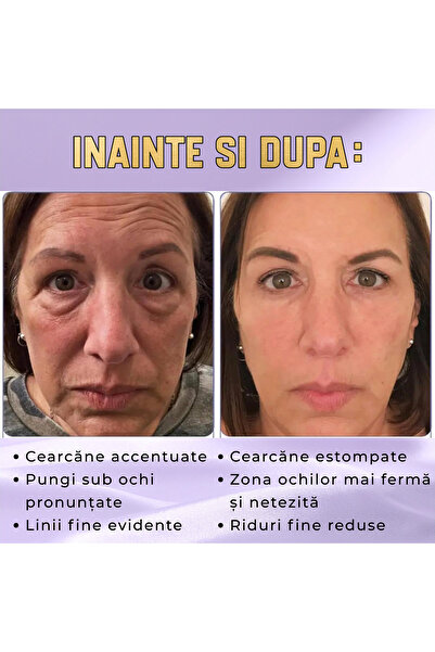 Hoygi Cremă contur ochi cu venin de albine și colagen, aplicator: cearcăne, pungi, linii fine, hidratează, tonifică, 20g