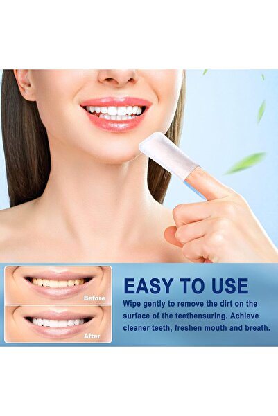 NALACAL Mint-Flavored Oral Wipes, Teeth Whitening, Portable Disposable, 60 Pcs